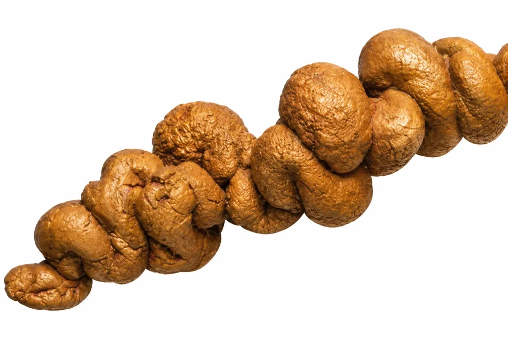 Coproliet
